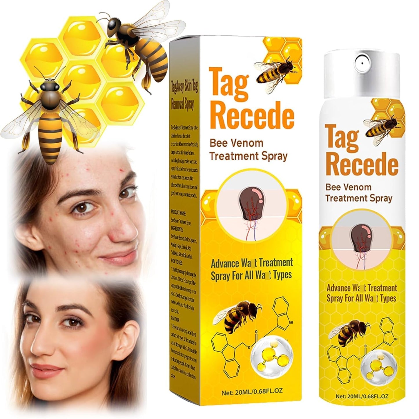 Tag Recede Bee Venom, Tag Recede Bee Venom Treatment Spray, TagRecede Bee Venom Treatment Spray (1 Piece)