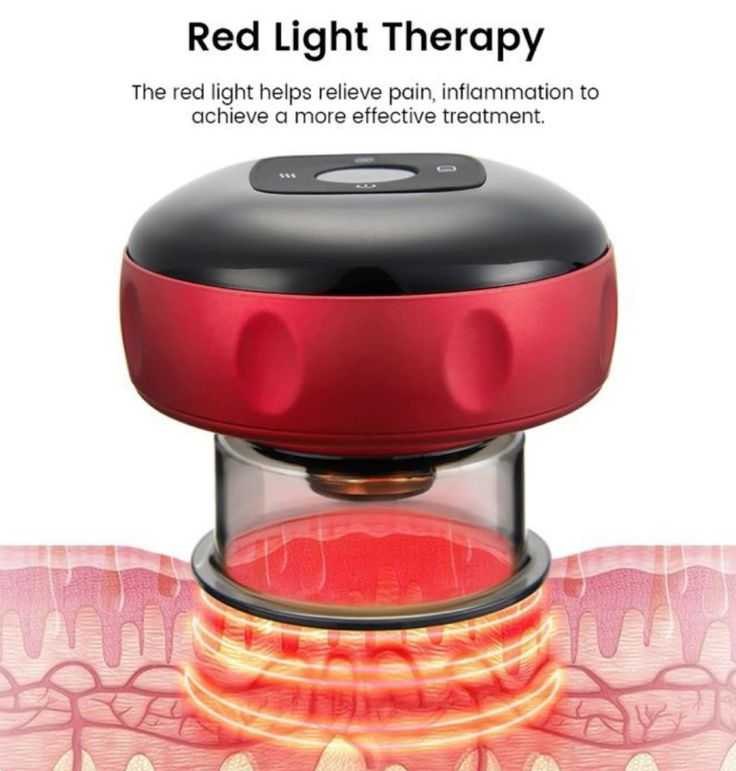 Electric Vacuum Cupping Massager