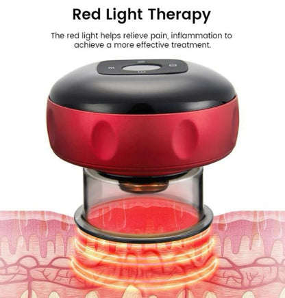 Electric Vacuum Cupping Massager