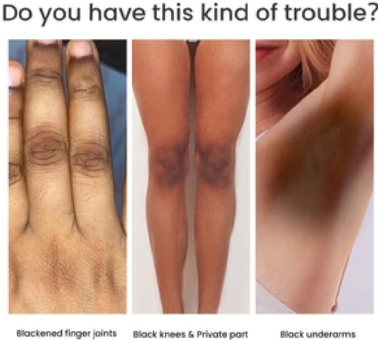 Women's Skin Pigmentation Care